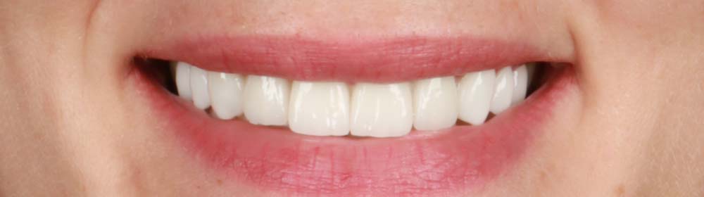 Smart Smile Design Smart Smile Design